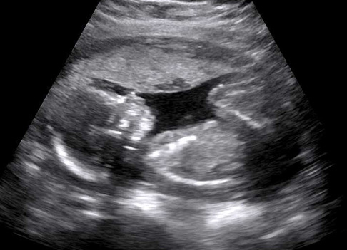 basic-ultrasound